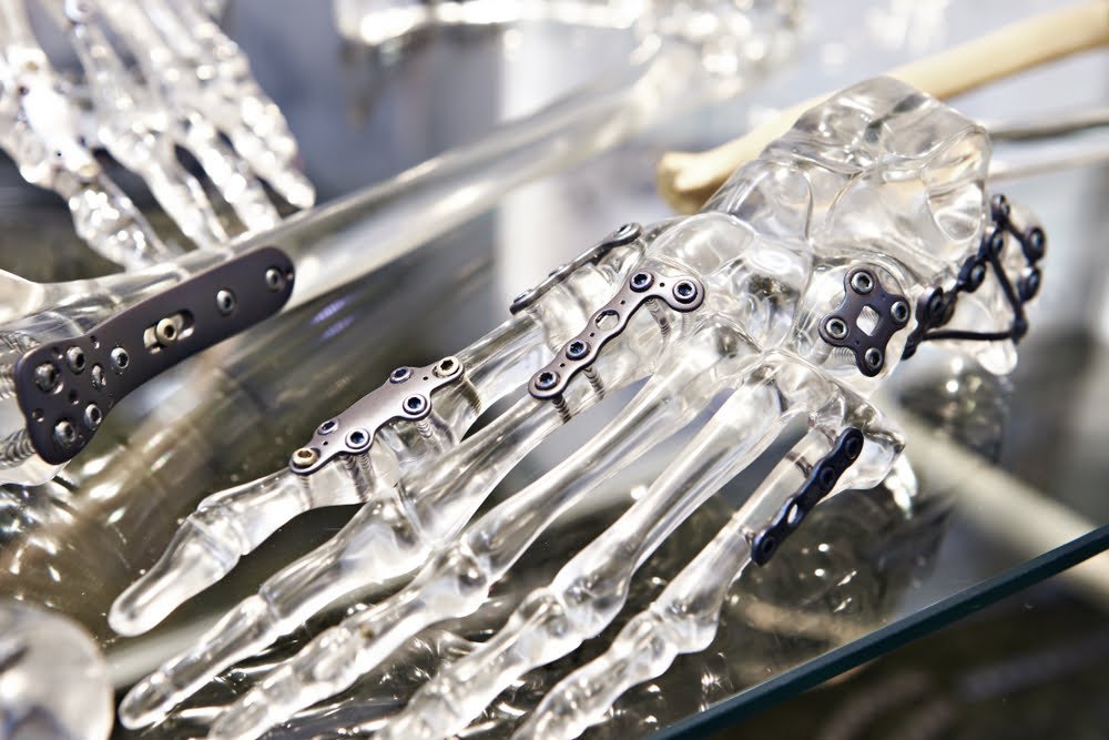 Trauma Implants Manufacturer